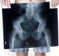 pelvisforweb Pelvis